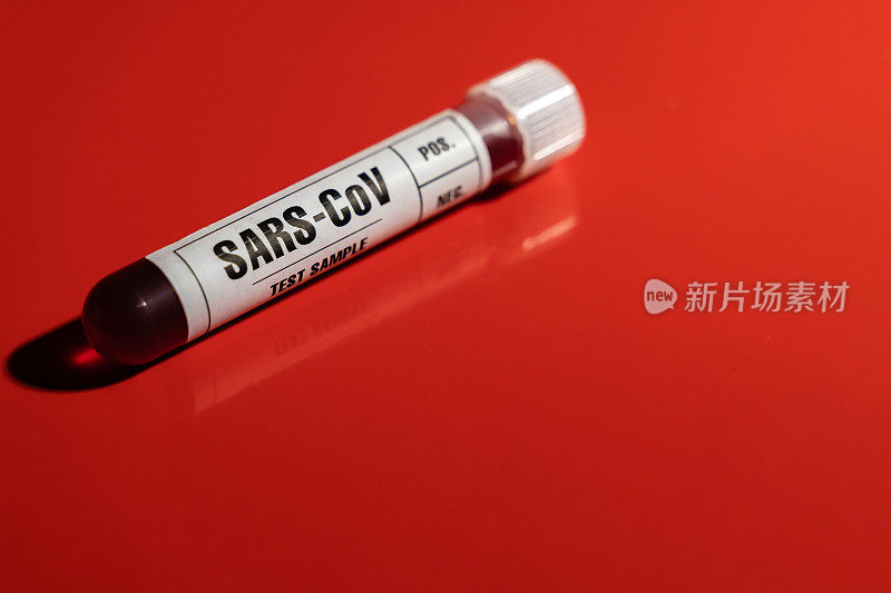 SARS-CoV (COVID-19)病毒血液检测采样管特写黄色标记，红色背景